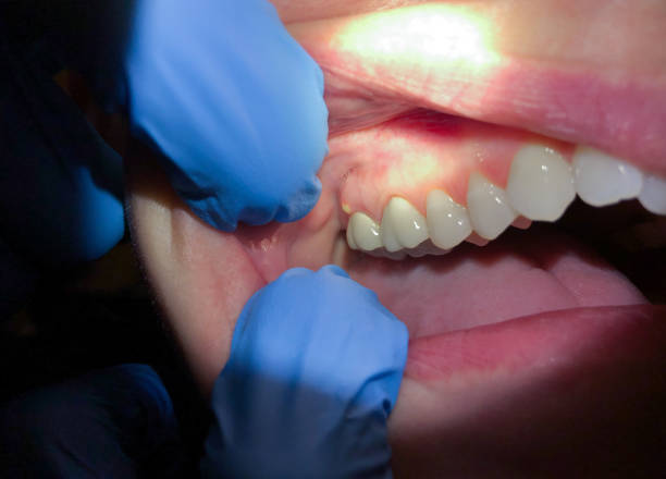 Best Emergency TMJ Treatment in Watford City, ND